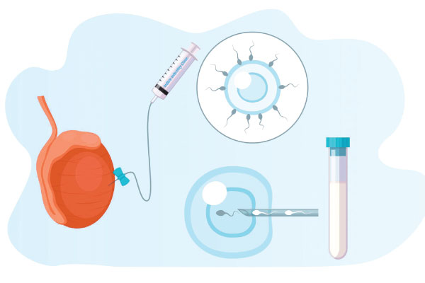 TESABlogPostFeaturedImage3