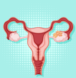 Premature Ovarian Failure