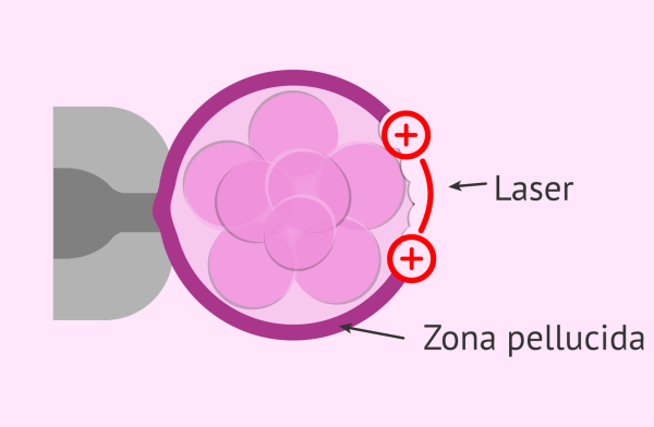 laser-embryo-zona-pellucida